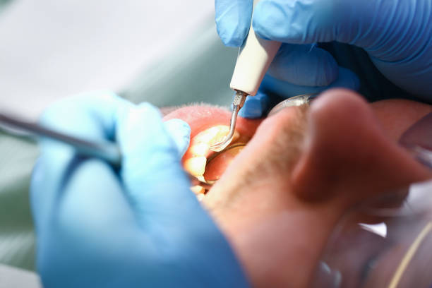 Best Emergency Treatment for Jaw Pain or Injury in Westke, LA