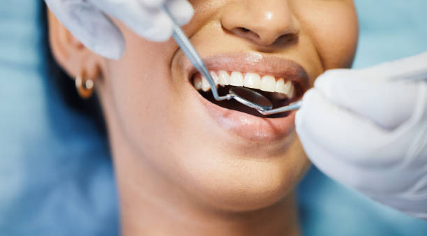 Best Broken or Chipped Tooth Repair in Westke, LA