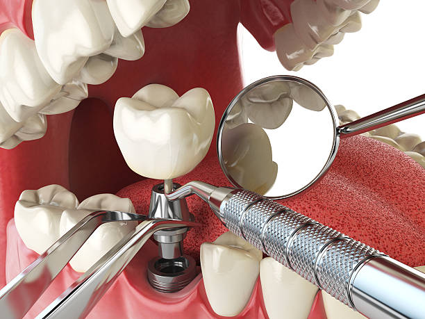 Best Weekend Emergency Dental Services in Westke, LA